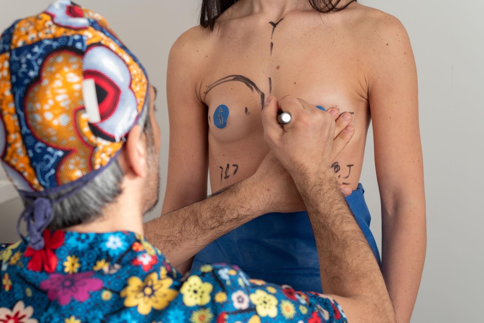 Mommy Makeover: ritrovare armonia dopo la maternità